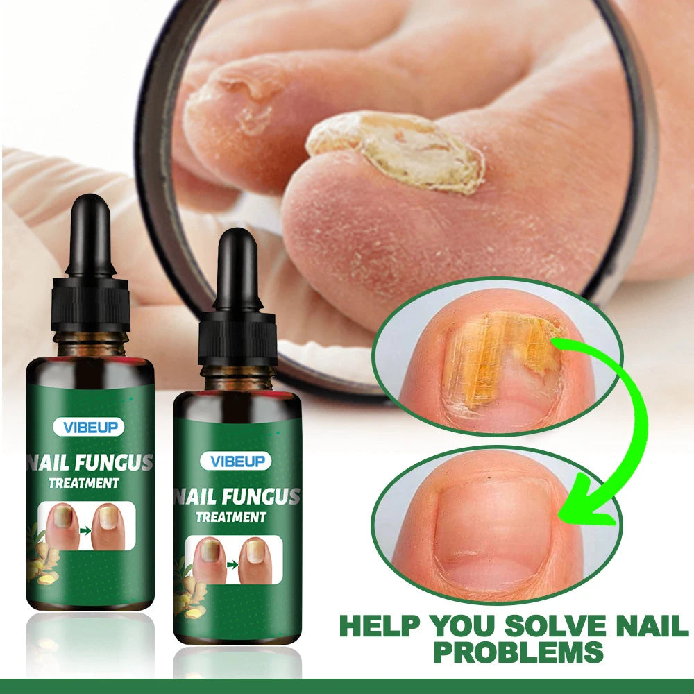 7 Days Fungal Nail Treatment Serum - Anti-Infection & Repair Gel